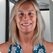 Janet from Canada showing her new smile after 24 dental crowns treatment