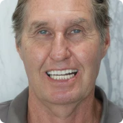 John's restored smile after comfortable restorative dentistry experience