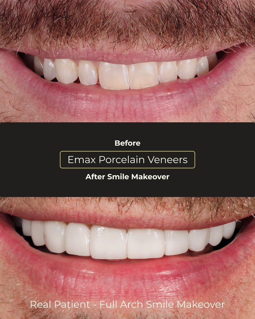 International patient review for Smile Makeover clinic