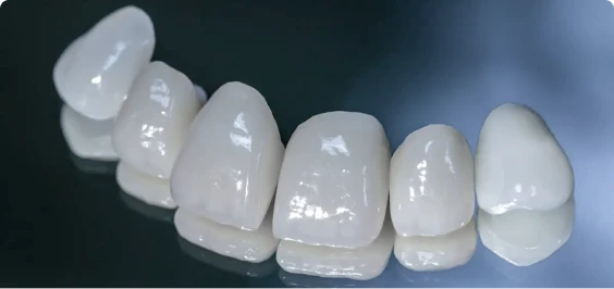 Cosmetic dental crowns smile makeover in Playa del Carmen Mexico