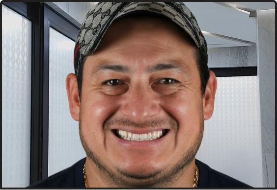 Affordable dental care pricing at Smile Makeover Playa del Carmen for expats and locals