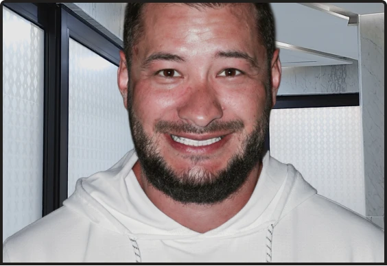 Smile makeover cost with dental crowns in Playa del Carmen