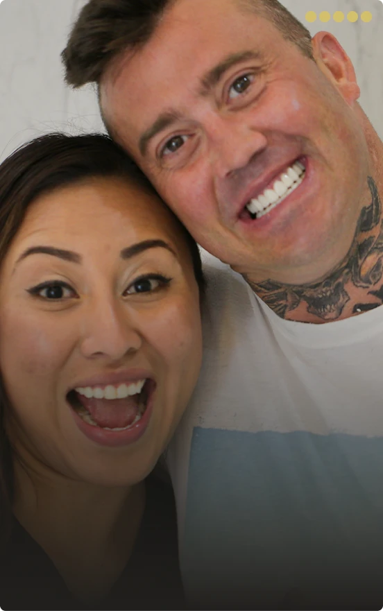 Final All-on-4 implant prosthesis and new smile in Playa del Carmen Mexico