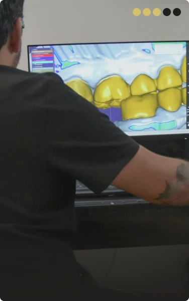 Step 3 digital impressions for custom dental crowns Playa del Carmen