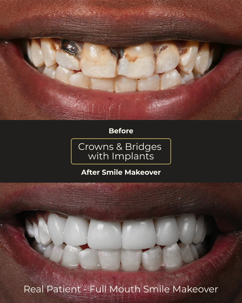 Patient comfortable during restorative dental treatment