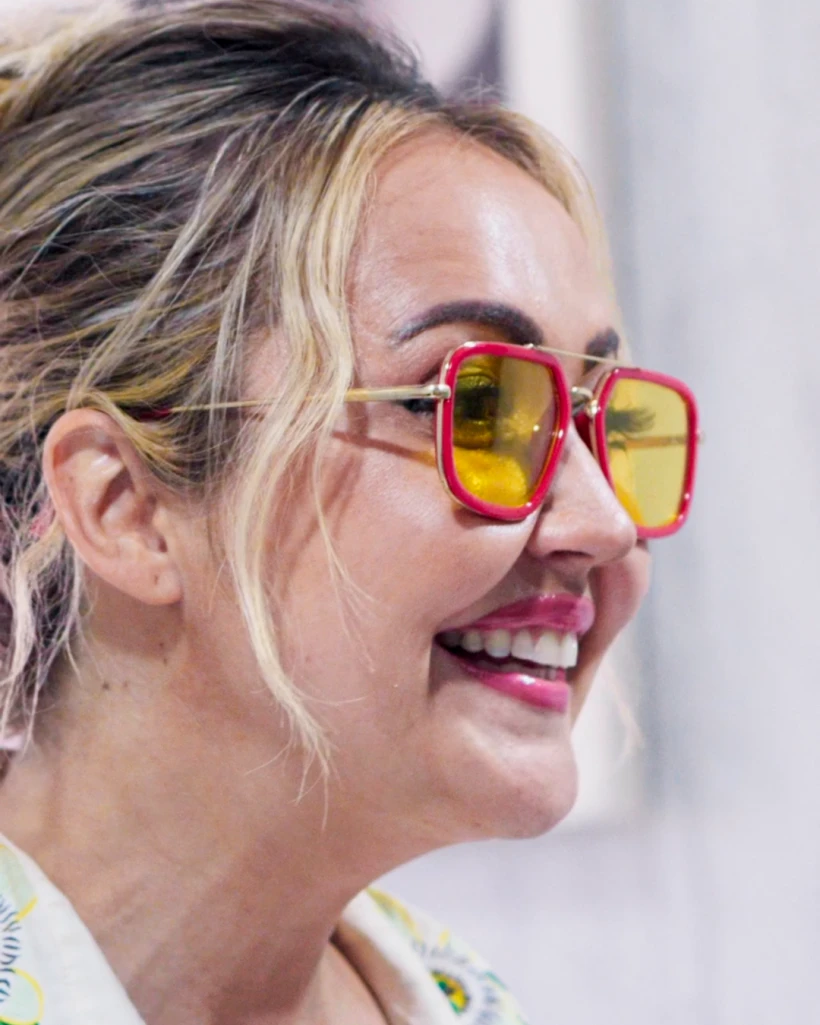 Natural-looking cosmetic dentistry smile transformation in Playa del Carmen