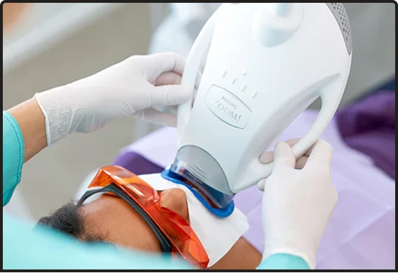 White diet examples to protect teeth whitening results