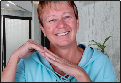 Before and after dental implant smile transformation All-on-4 Playa del carmen