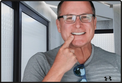 Before and after dental implant smile transformation All-on-4 Smilemakeover