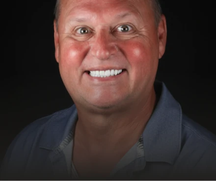 Portrait of a confident male patient showcasing his bright new smile with Porcelain and Zirconia Crowns.