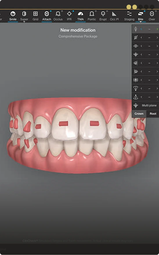 Step 2: Creating your digital orthodontic treatment roadmap
