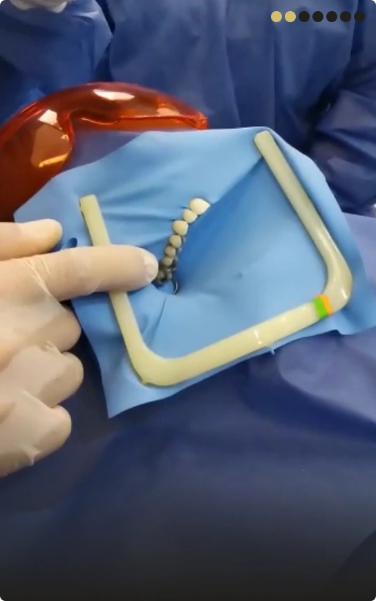 Step 2: Applying protective barriers to prevent mercury ingestion