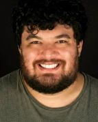 Aesthetic dental smile design results at Smile Makeover Playa del Carmen