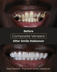 Detailed view of cosmetic dentistry work of art by certified specialists