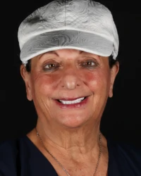 Complex full mouth restoration results by Dr. Martha Tziu