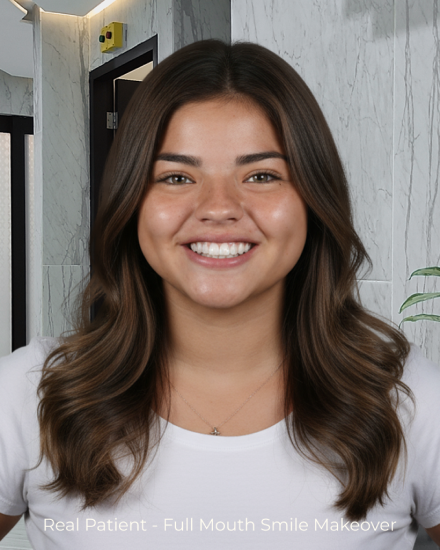 Patient smiling after a full smile makeover with porcelain veneers at our affordable dental clinic.