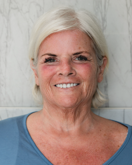Female patient after receiving cosmetic dental treatment, showcasing a brighter and more youthful smile.