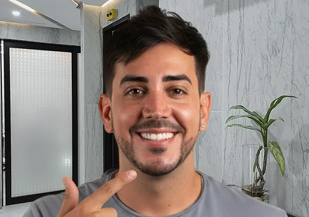 Smile Makeover in Playa del Carmen Before and After
