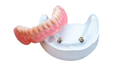 Clip on dentures in playa del carmen