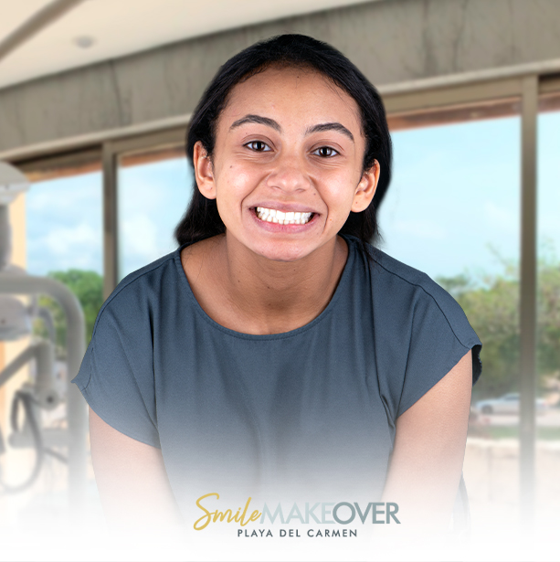 Complete smile makeover in mexico