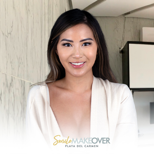 Full dental smile makeover in playa del carmen