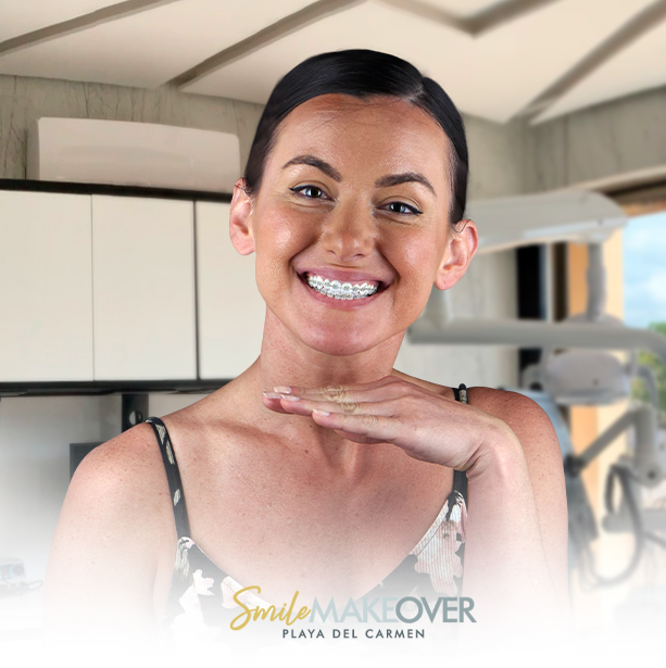 woman with her hair slicked back at Smile makeover braces in playa del carmen