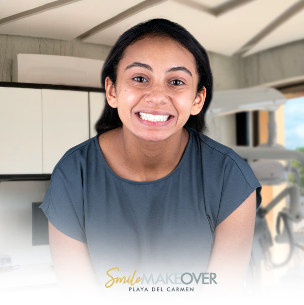 Cheerful woman with her hair tied back with teeth whitening at smile makeover