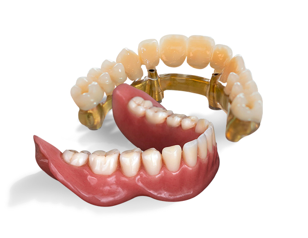 All on 4-denta implants in playa-del-carmen