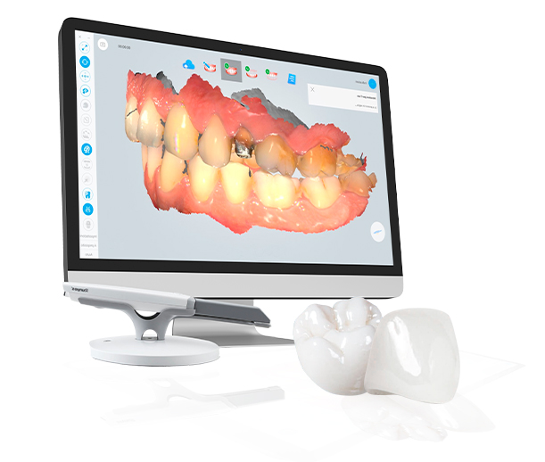 dental software interface at smile makeover