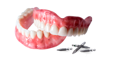 snap on dentures with mini implants