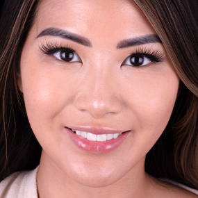 Close-up of a young woman with veneers in cancun